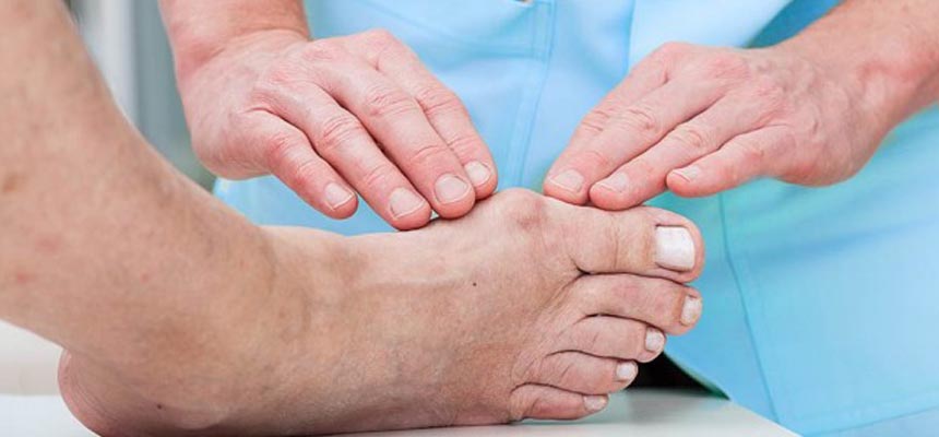 How to deal with Gout