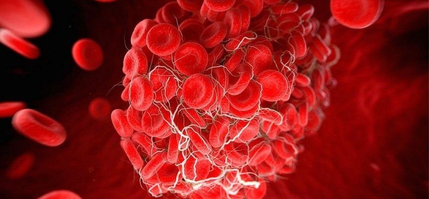 Correlation of Blood Clots and Covid Vaccine