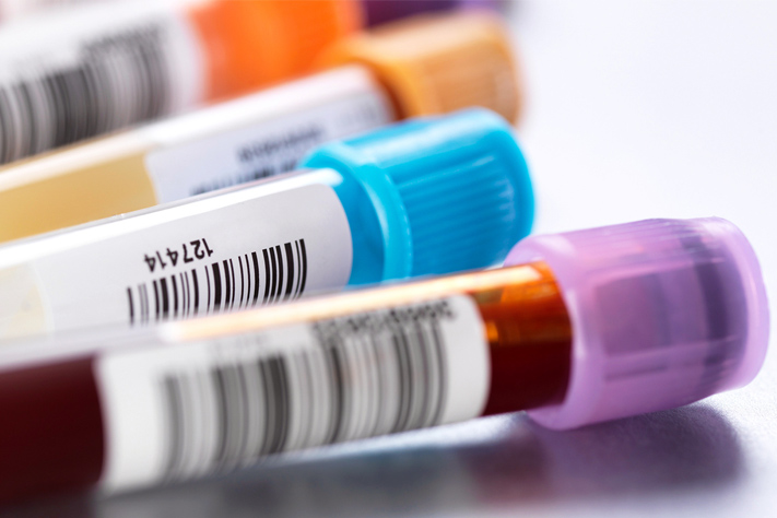Point-Of-Care Testing Paves The Way For Anemia Eradication 