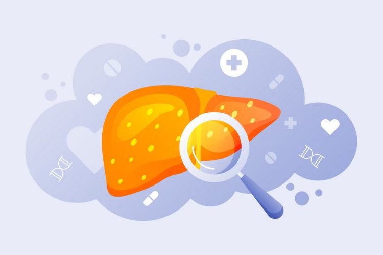 Alcoholic Liver Disease: A Growing Concern